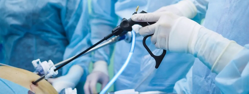 Advanced Laparoscopic Cancer Surgery